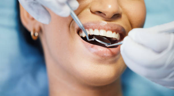 Best Emergency Dentist for Lost Fillings or Crowns in Masontown, PA